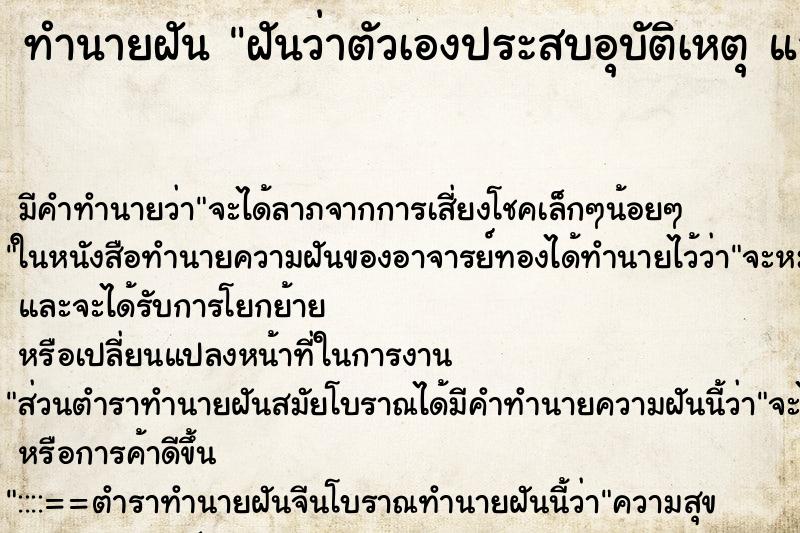 ทำนายฝันฝันว่าตัวเองประสบอุบัติเหตุแล้วตาย ทำนายฝันทำนายฝันฝันว่าตัวเองประสบอุบัติเหตุแล้วตาย